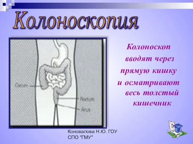 Коновалова Н.Ю. ГОУ СПО "ГМУ" Колоноскоп вводят через прямую кишку и осматривают весь толстый кишечник Колоноскопия