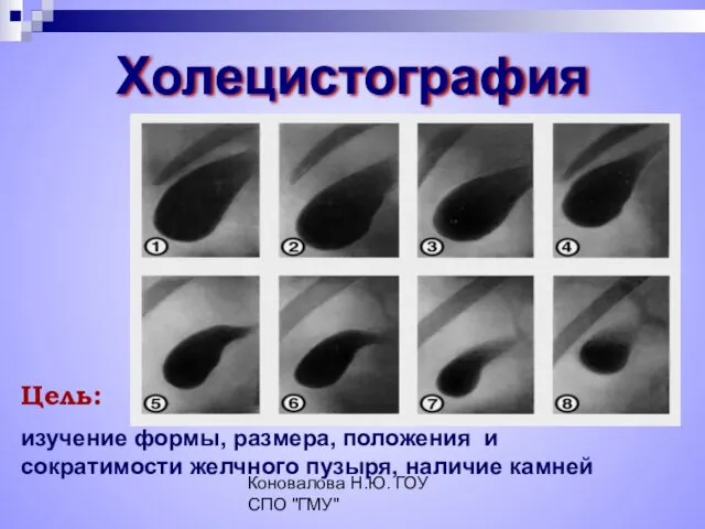 Коновалова Н.Ю. ГОУ СПО "ГМУ" Холецистография Цель: изучение формы, размера, положения