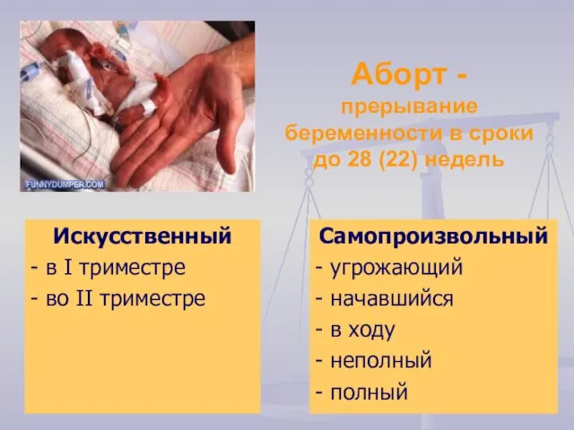 Аборт - прерывание беременности в сроки до 28 (22) недель Искусственный