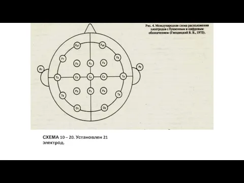 СХЕМА 10 – 20. Установлен 21 электрод.