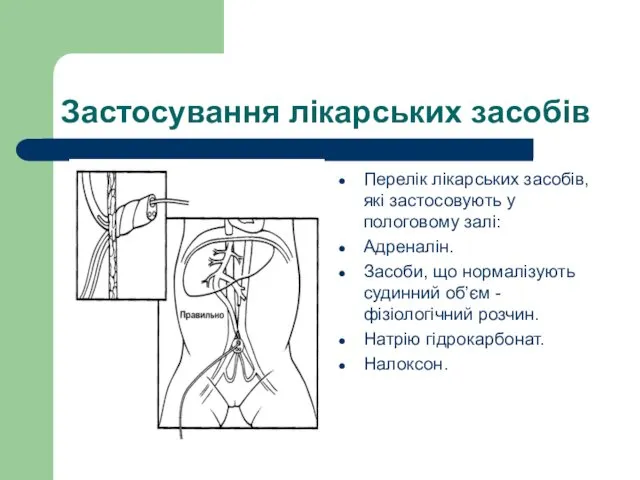 Застосування лікарських засобів Перелік лікарських засобів, які застосовують у пологовому залі: