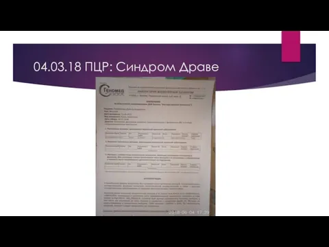 04.03.18 ПЦР: Синдром Драве