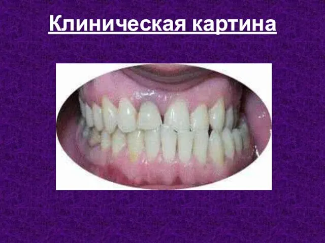 Клиническая картина