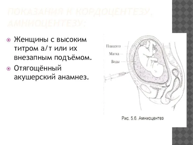 ПОКАЗАНИЯ К КОРДОЦЕНТЕЗУ, АМНИОЦЕНТЕЗУ: Женщины с высоким титром а/т или их внезапным подъёмом. Отягощённый акушерский анамнез.