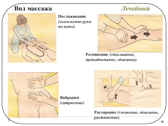 Вид массажа Лечебный Поглаживание (скольжение руки по коже) Растирание (смещение, сдвигание,