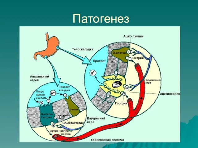 Патогенез