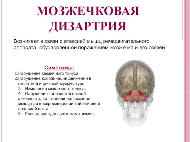 МОЗЖЕЧКОВАЯ ДИЗАРТРИЯ Возникает в связи с атаксией мышц речедвигательного аппарата, обусловленной