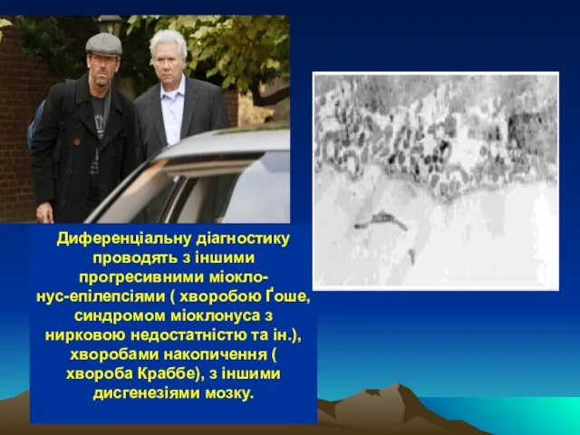 Диференціальну діагностику проводять з іншими прогресивними міокло- нус-епілепсіями ( хворобою Ґоше,