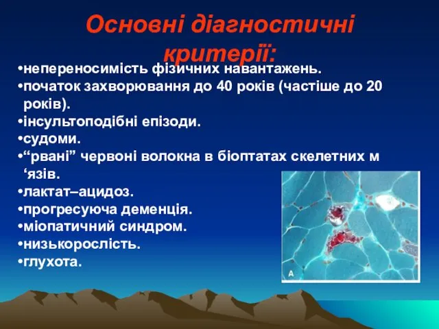 Основні діагностичні критерії: непереносимість фізичних навантажень. початок захворювання до 40 років