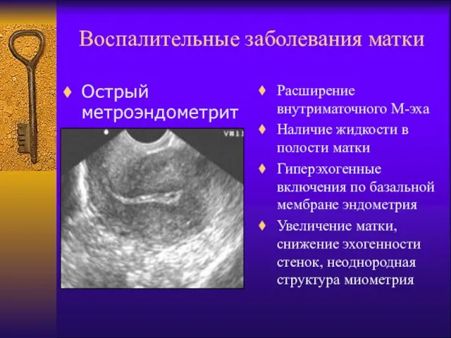 Воспалительные заболевания матки Острый метроэндометрит Расширение внутриматочного М-эха Наличие жидкости в