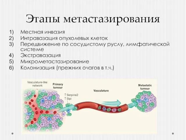 Этапы метастазирования Местная инвазия Интравазация опухолевых клеток Передвижение по сосудистому руслу,