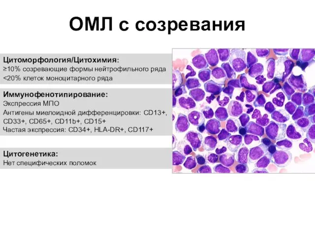 ОМЛ с созревания Цитоморфология/Цитохимия: ≥10% созревающие формы нейтрофильного ряда Иммунофенотипирование: Экспрессия