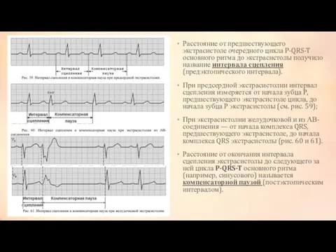 Расстояние от предшествующего экстрасистоле очередного цикла P-QRS-T основного ритма до экстрасистолы