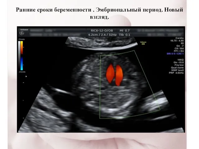 Ранние сроки беременности . Эмбриональный период. Новый взгляд.