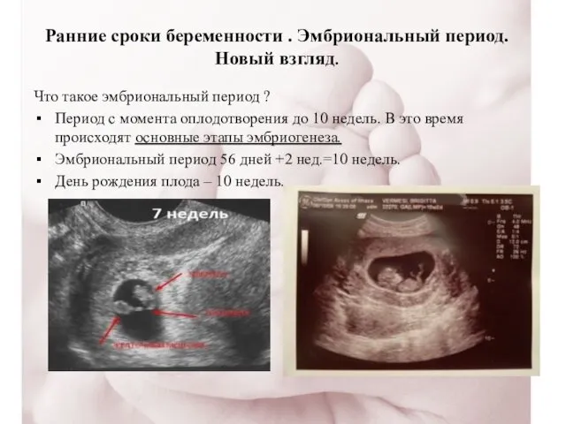 Ранние сроки беременности . Эмбриональный период. Новый взгляд. Что такое эмбриональный