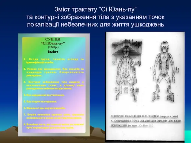 Зміст трактату “Сі Юань-лу” та контурні зображення тіла з указанням точок локалізації небезпечних для життя ушкоджень