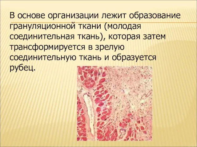 В основе организации лежит образование грануляционной ткани (молодая соединительная ткань), которая