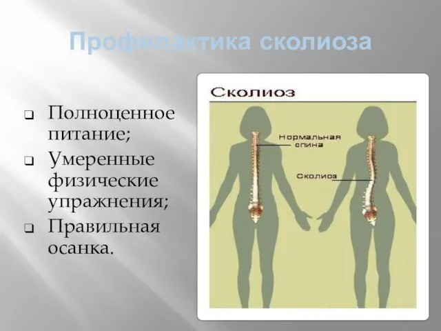 Профилактика сколиоза Полноценное питание; Умеренные физические упражнения; Правильная осанка.