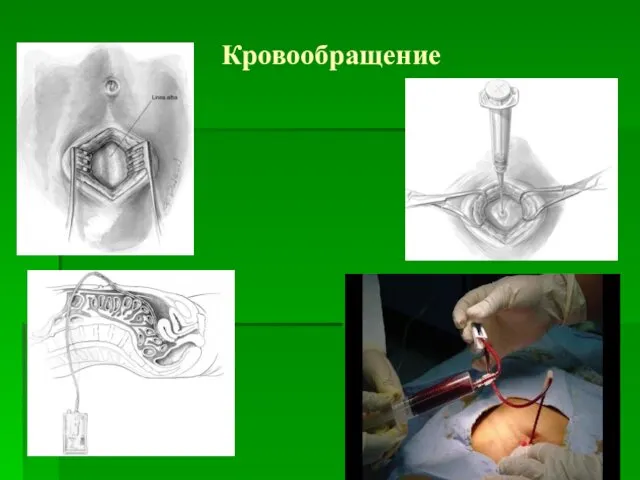 Кровообращение