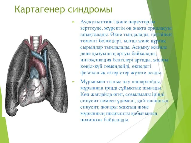 Картагенер синдромы Аускультативті және перкуторлы зерттеуде, жүректің оң жақта орналасуы анықталады.