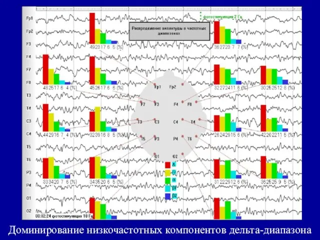 Доминирование низкочастотных компонентов дельта-диапазона