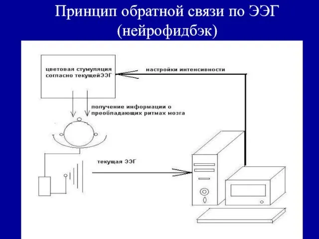 Принцип обратной связи по ЭЭГ (нейрофидбэк)