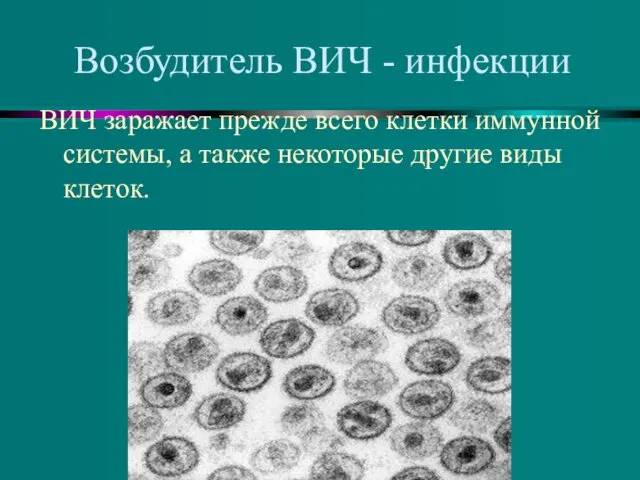 Возбудитель ВИЧ - инфекции ВИЧ заражает прежде всего клетки иммунной системы,