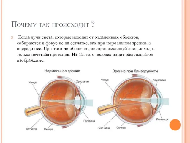 Почему так происходит ? Когда лучи света, которые исходят от отдаленных