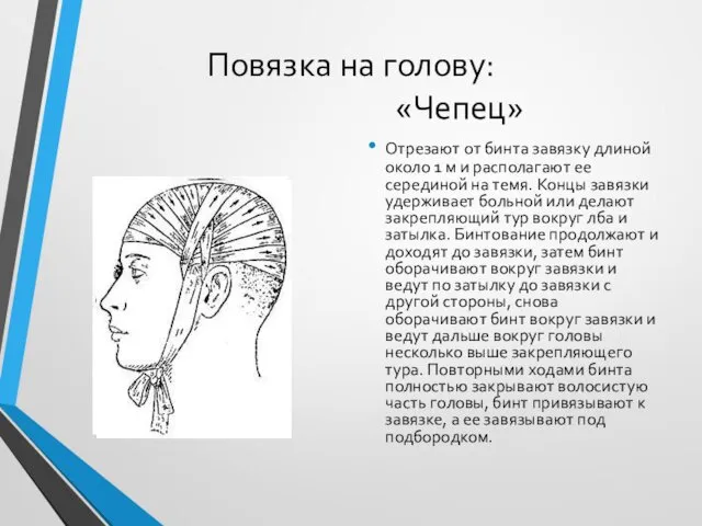 Повязка на голову: «Чепец» Отрезают от бинта завязку длиной около 1