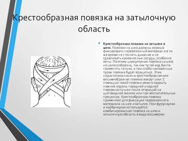 Крестообразная повязка на затылочную область Крестообразная повязка на затылок и шею.