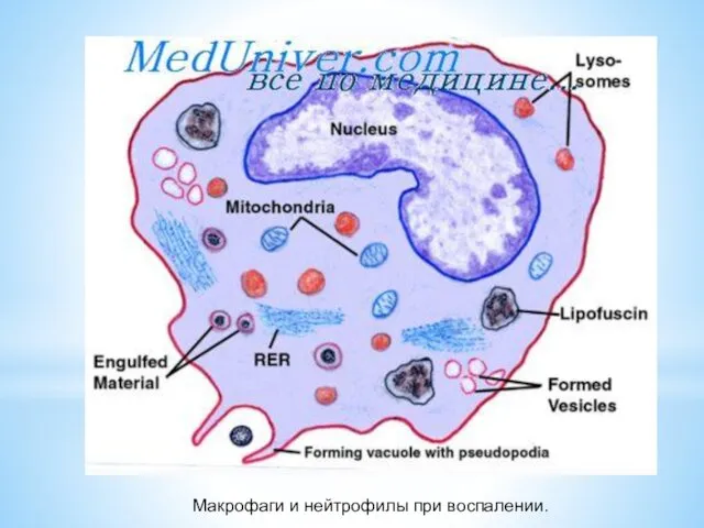 Макрофаги и нейтрофилы при воспалении.