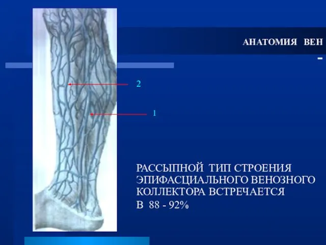 РАССЫПНОЙ ТИП СТРОЕНИЯ ЭПИФАСЦИАЛЬНОГО ВЕНОЗНОГО КОЛЛЕКТОРА ВСТРЕЧАЕТСЯ В 88 - 92% АНАТОМИЯ ВЕН - 1 2