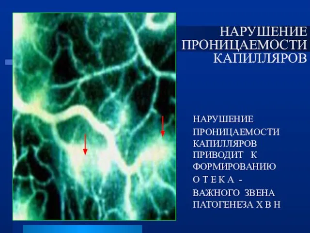 НАРУШЕНИЕ ПРОНИЦАЕМОСТИ КАПИЛЛЯРОВ НАРУШЕНИЕ ПРОНИЦАЕМОСТИ КАПИЛЛЯРОВ ПРИВОДИТ К ФОРМИРОВАНИЮ О Т