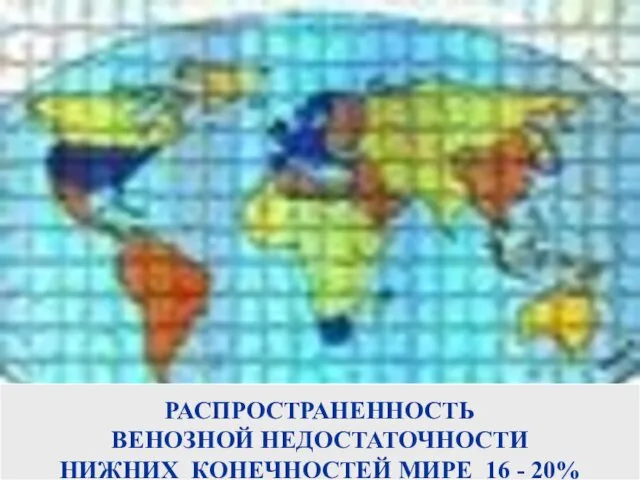 РАСПРОСТРАНЕННОСТЬ ВЕНОЗНОЙ НЕДОСТАТОЧНОСТИ НИЖНИХ КОНЕЧНОСТЕЙ МИРЕ 16 - 20%