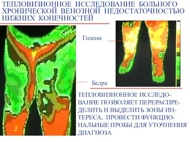 ТЕПЛОВИЗИОННОЕ ИССЛЕДО- ВАНИЕ ПОЗВОЛЯЕТ ПЕРЕРАСПРЕ- ДЕЛИТЬ И ВЫДЕЛИТЬ ЗОНЫ ИН- ТЕРЕСА,