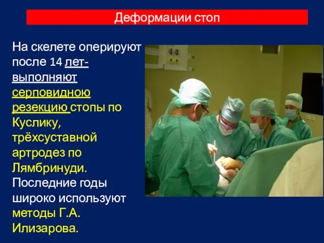 Деформации стоп На скелете оперируют после 14 лет- выполняют серповидною резекцию