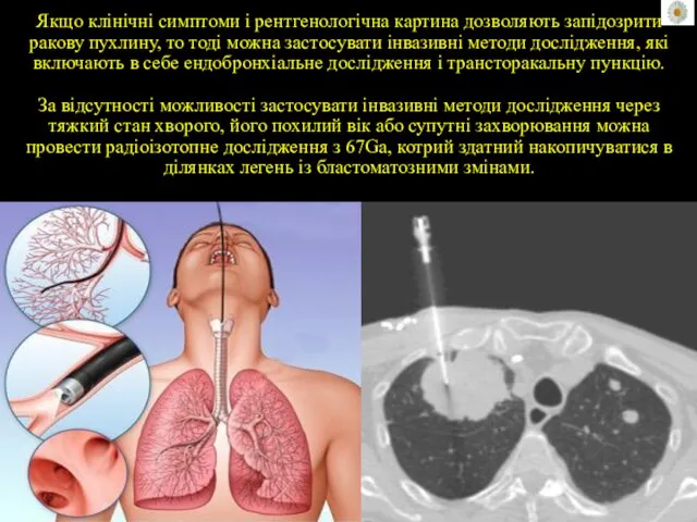 Якщо клінічні симптоми і рентгенологічна картина дозволяють запідозрити ракову пухлину, то