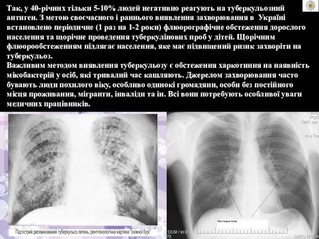 Так, у 40-річних тільки 5-10% людей негативно реагують на туберкульозний антиген.