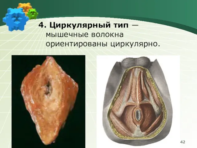 4. Циркулярный тип ― мышечные волокна ориентированы циркулярно.