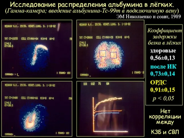 Коэффициент задержки белка в лёгких здоровые 0,56±0,13 после ИК 0,73±0,14 ОРДС