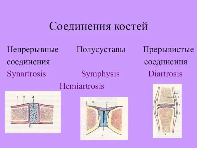 Соединения костей Непрерывные Полусуставы Прерывистые cоединения cоединения Synartrosis Symphysis Diartrosis Hemiartrosis