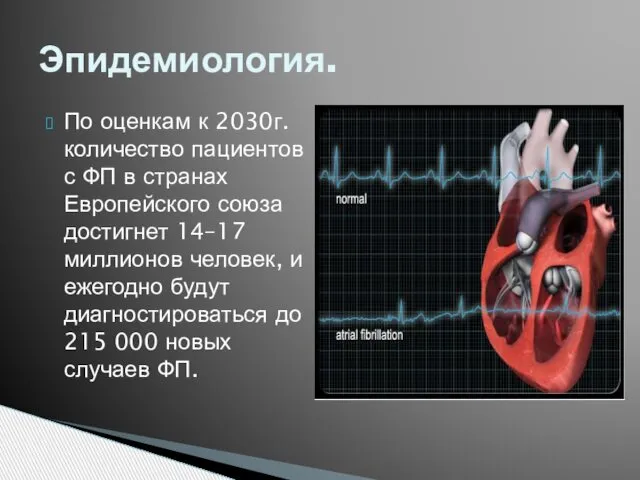 По оценкам к 2030г. количество пациентов с ФП в странах Европейского