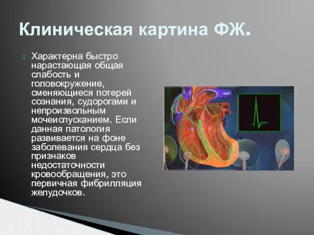 Характерна быстро нарастающая общая слабость и головокружение, сменяющиеся потерей сознания, судорогами