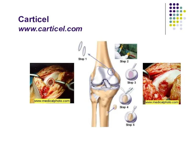 Carticel www.carticel.com