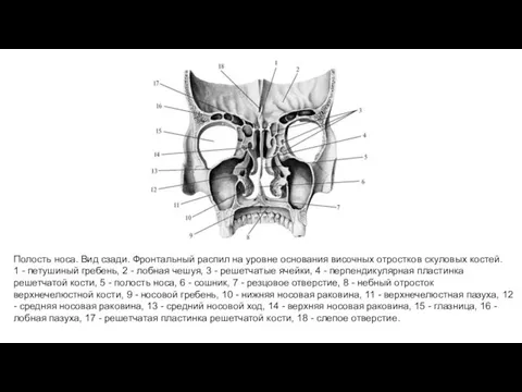 Полость носа. Вид сзади. Фронтальный распил на уровне основания височных отростков