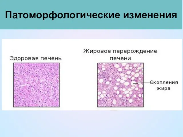 Патоморфологические изменения