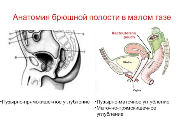 Анатомия брюшной полости в малом тазе Пузырно-прямокишечное углубление Пузырно-маточное углубление Маточно-прямокишечное углубление