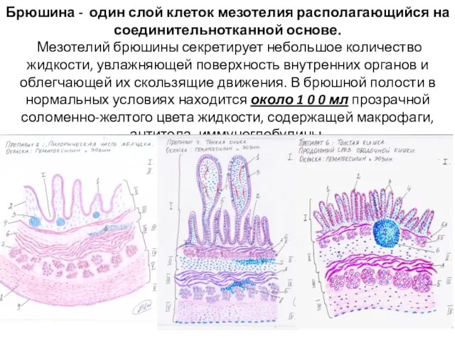 Брюшина - один слой клеток мезотелия располагающийся на соединительнотканной основе. Мезотелий