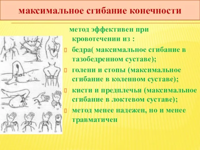 метод эффективен при кровотечении из : бедра( максимальное сгибание в тазобедренном