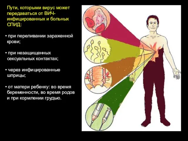 Пути, которыми вирус может передаваться от ВИЧ-инфицированных и больных СПИД: при